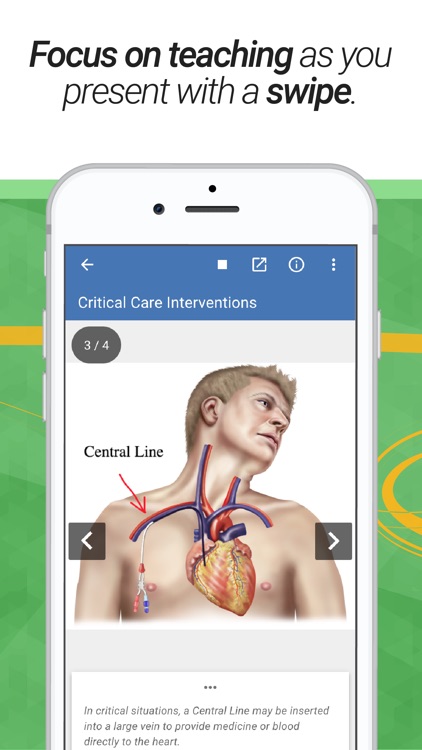 drawMD® - Patient Education