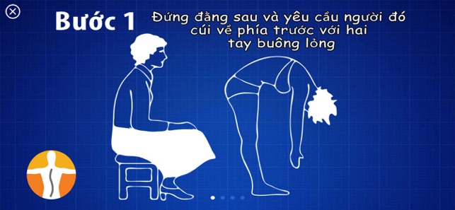 Thước đo cong vẹo cột sống