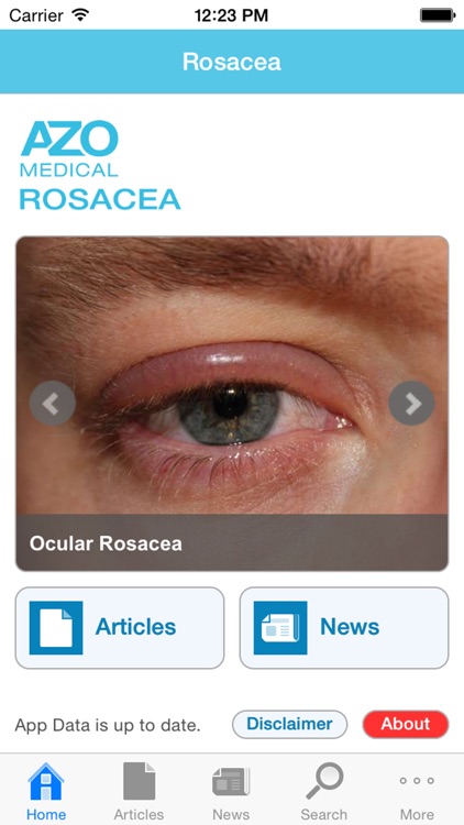 Rosacea by AZoMedical