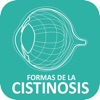Cistinosis
