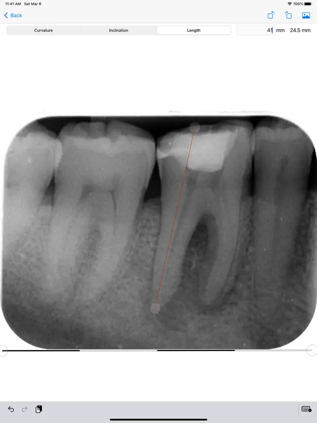 Captura 4 EndoPrep iphone