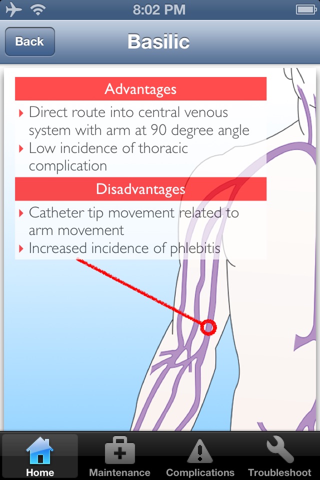 Catheter Pro screenshot 3