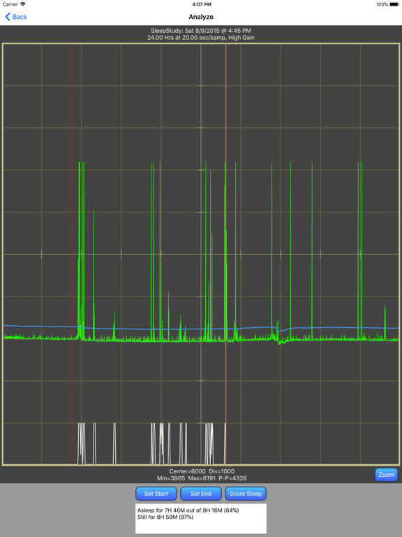 Screenshot #4 pour AuraLogger