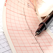 ECG EKG Viewer for Polar H10