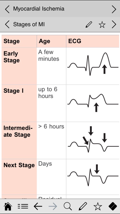 ECG pocketcards screenshot-3