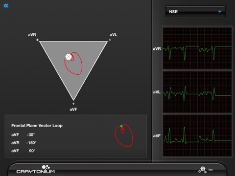 Craytonium ECG screenshot 4