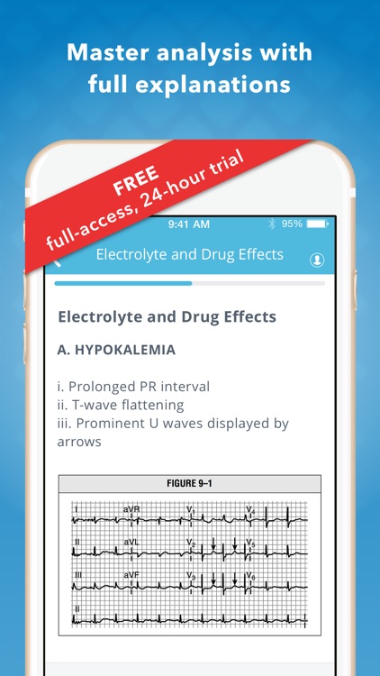 ECG EKG Mastery
