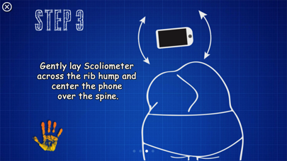 Scoliometer Screenshot 5