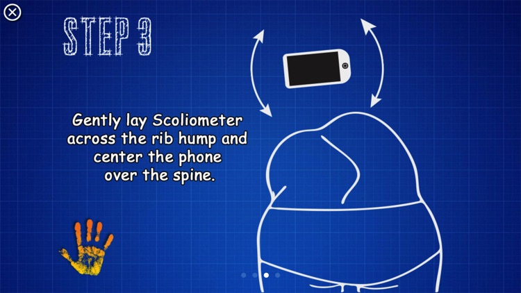 Scoliometer screenshot-4