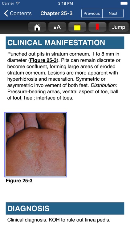 Fitzpatrick's Atlas & Synopsis of Dermatology, 8/E