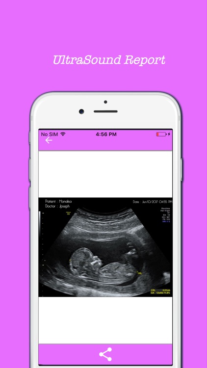 Ultrasound Scanner prank screenshot-3