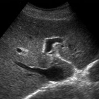 ARDMS Abdomen Ultrasound Flashcards for Boards PC 용