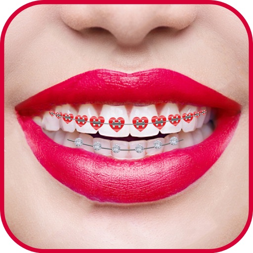 Braces Teeth Photo Editor by Hardik Savaliya