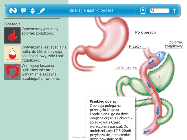 Bariatria(圖2)-速報App