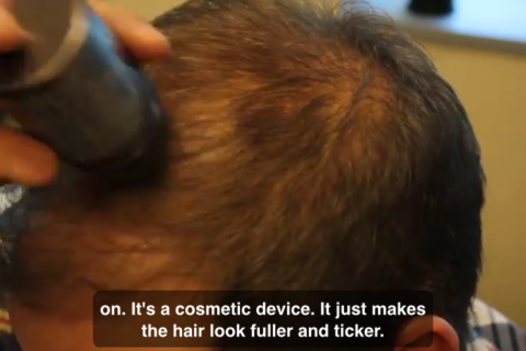 How To Treat Thinning Hair screenshot 4