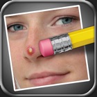 Effaceur d'imperfections (Pimple Eraser) icon