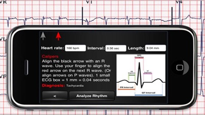 ECG Interpreter Screenshot 4