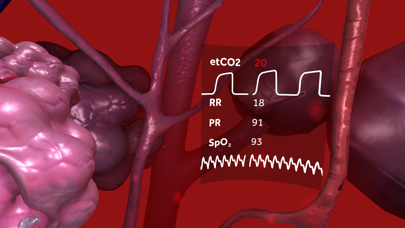 How to cancel & delete Respiratory Compromise: Journey to the Lungs from iphone & ipad 1