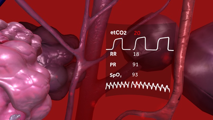 Respiratory Compromise: Journey to the Lungs