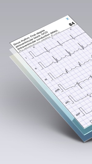 ECG心電圖书Pro - ECG (EKG) Books(圖4)-速報App