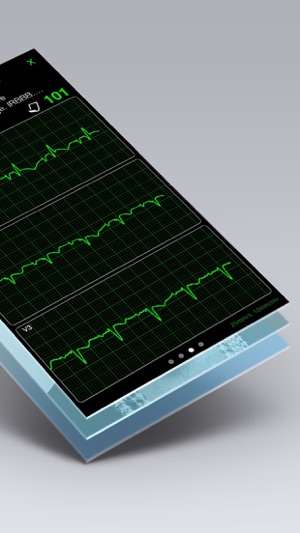 ECG心電圖书Pro - ECG (EKG) Books(圖5)-速報App