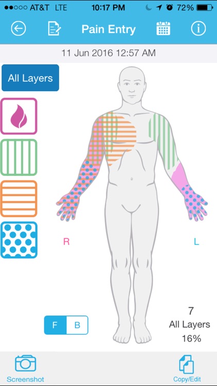 Pain Tracker & Diary by Nanolume®.