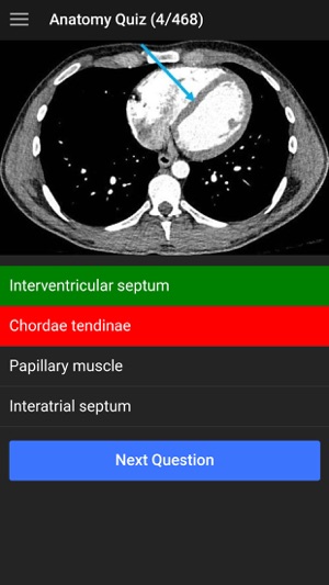 UBC Radiology(圖3)-速報App