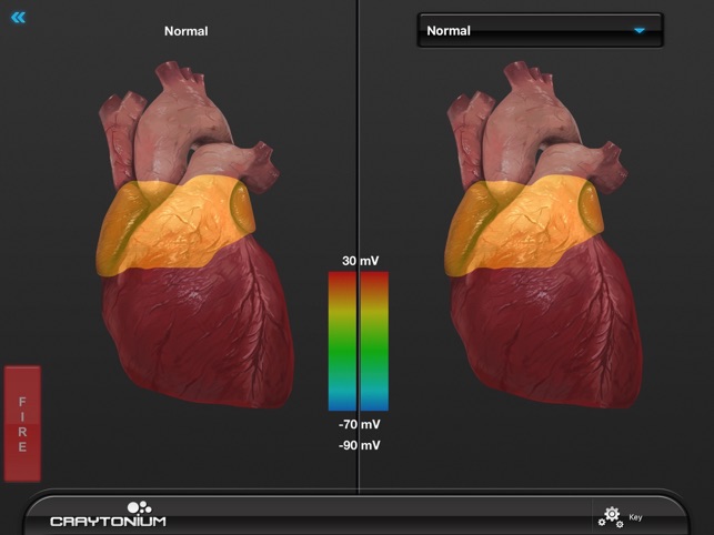 Craytonium ECG(圖1)-速報App