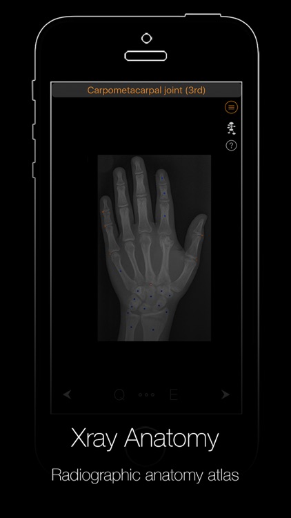 Xray Anatomy
