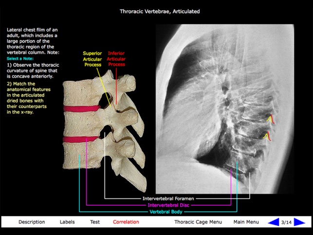 Gross Anatomy of the Skeleton(圖3)-速報App