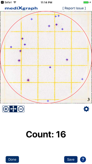 Grid CFU Scope(圖2)-速報App