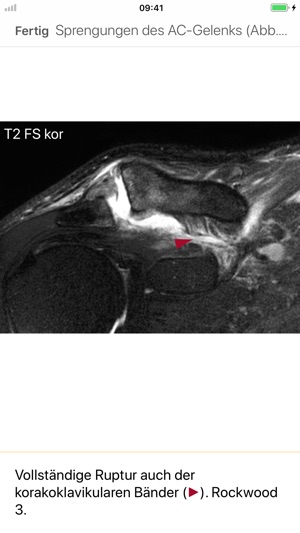 MRI-Essentials