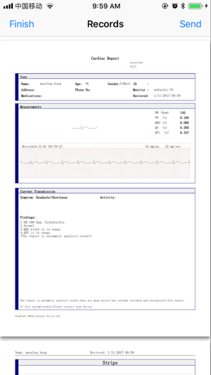 WeCardio(圖4)-速報App