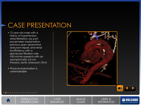 Aortic IVUS screenshot 3