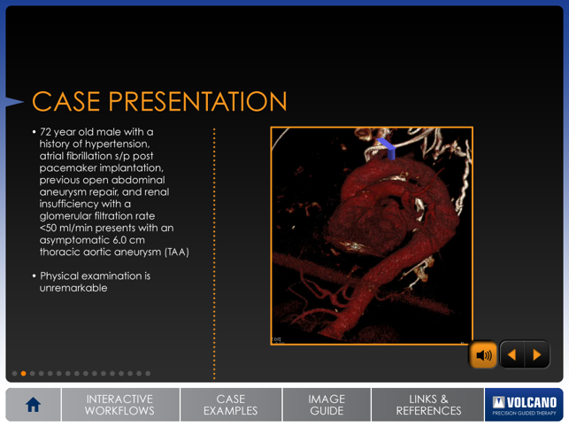 Aortic IVUS(圖3)-速報App