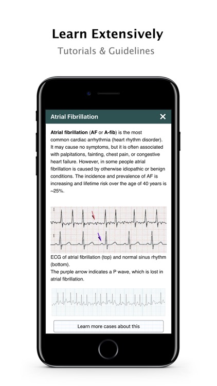 ECG Pro - Cases, Exams, Compendiums for CME & EMT screenshot-4