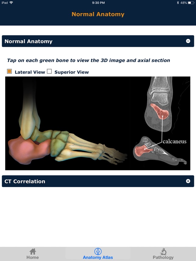 CTisus: CT of the Foot(圖2)-速報App