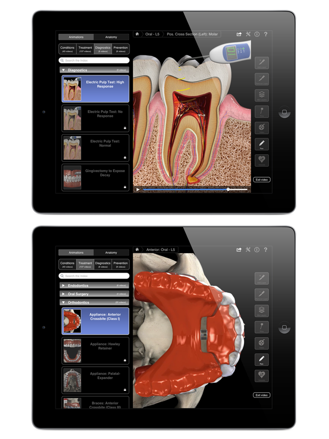 Dental Patient Education Lite(圖5)-速報App