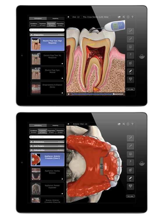 Dental Patient Education Lite screenshot-4
