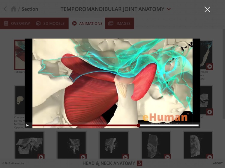 Head and Neck Anatomy 3 screenshot-7