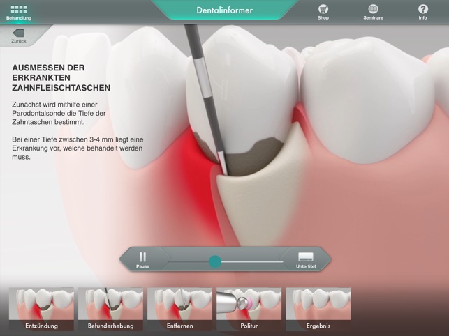 Dentalinformer(圖4)-速報App