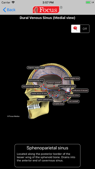 How to cancel & delete NEUROANATOMY - Digital Anatomy from iphone & ipad 4