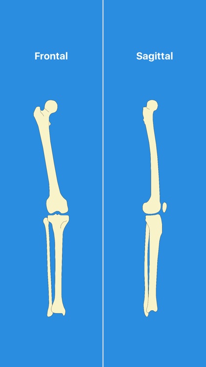 OsteoGauge - lower limb