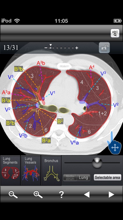 Chest CT Sectional Walker