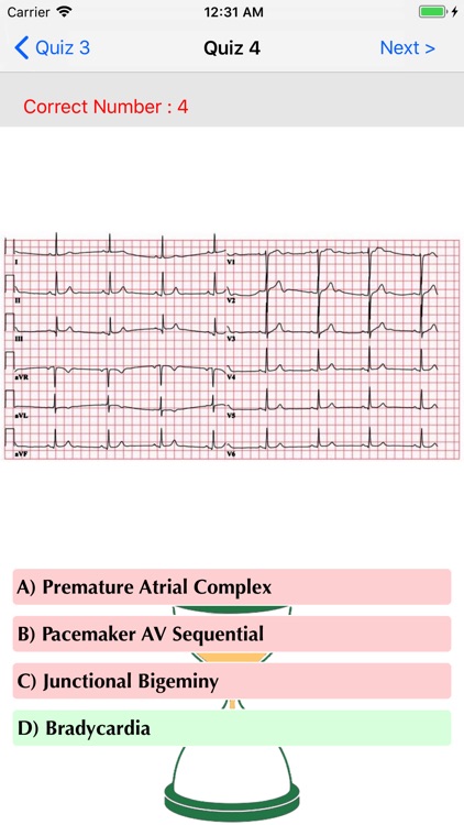 ECG QUIZ START screenshot-3