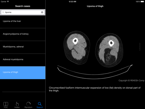 Atlas of Radiological Images screenshot 4