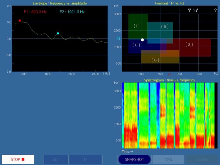 Onmon - Audio & Voice Analyzer screenshot-5