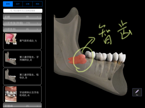 3D口腔医患沟通 screenshot 2