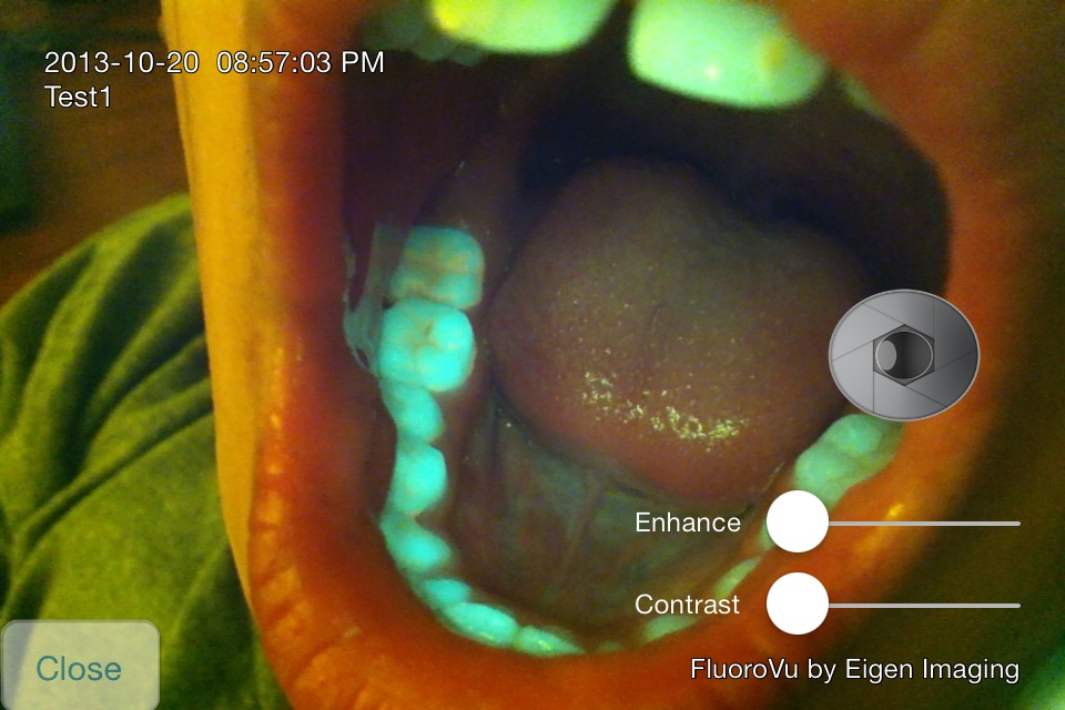 FluoroVu screenshot 4