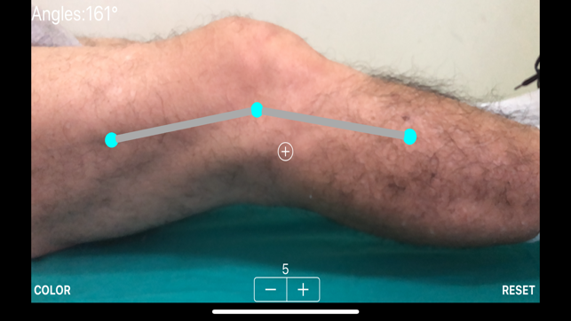 ARorthopaedicGoniometer(圖4)-速報App